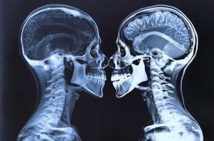 Чим відрізняється КТ від МРТ: коли що призначають